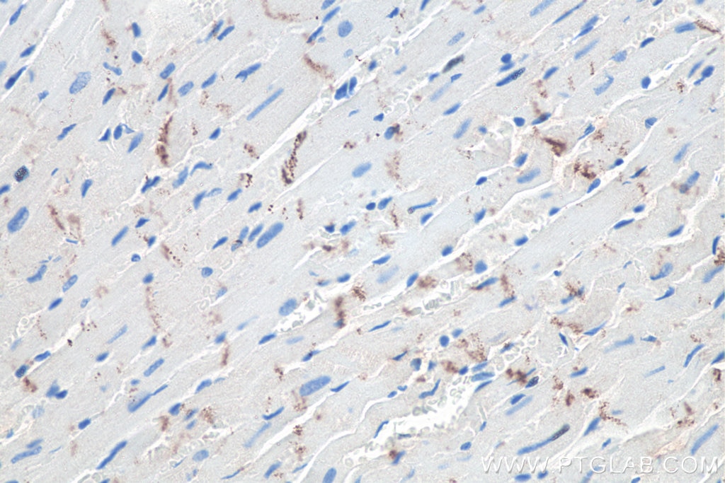 Immunohistochemistry (IHC) staining of rat heart tissue using N-cadherin Monoclonal antibody (66219-1-Ig)