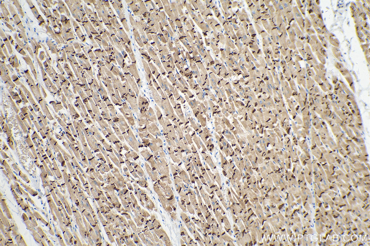 IHC staining of human heart using 66219-1-Ig Immunohistochemistry (IHC) staining of human heart tissue using N-cadherin Monoclonal antibody (66219-1-Ig)
