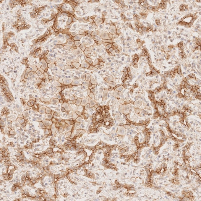 IHC staining of human liver using 66219-1-Ig Immunohistochemistry (IHC) staining of human liver tissue using N-cadherin Monoclonal antibody (66219-1-Ig)