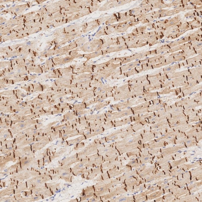 IHC staining of human heart using 66219-1-Ig Immunohistochemistry (IHC) staining of human heart tissue using N-cadherin Monoclonal antibody (66219-1-Ig)