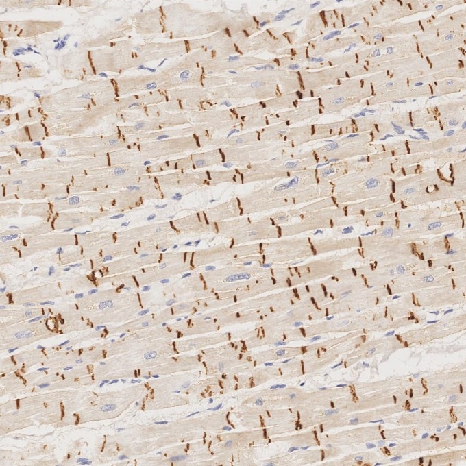 IHC staining of human heart using 66219-1-Ig Immunohistochemistry (IHC) staining of human heart tissue using N-cadherin Monoclonal antibody (66219-1-Ig)