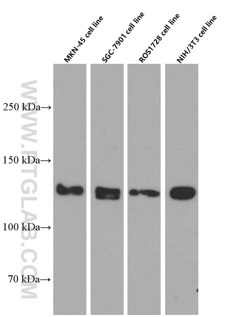 Western Blot (WB) analysis of MKN-45 cells using N-cadherin Monoclonal antibody (66219-1-Ig)