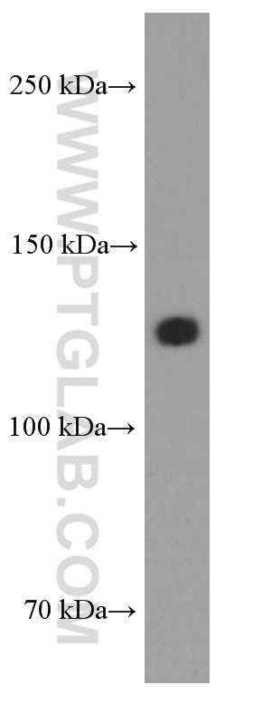 WB analysis of human heart using 66219-1-Ig