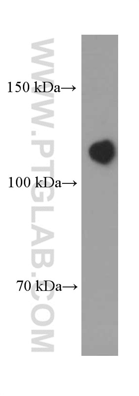 Western Blot (WB) analysis of pig brain tissue using N-cadherin Monoclonal antibody (66219-1-Ig)