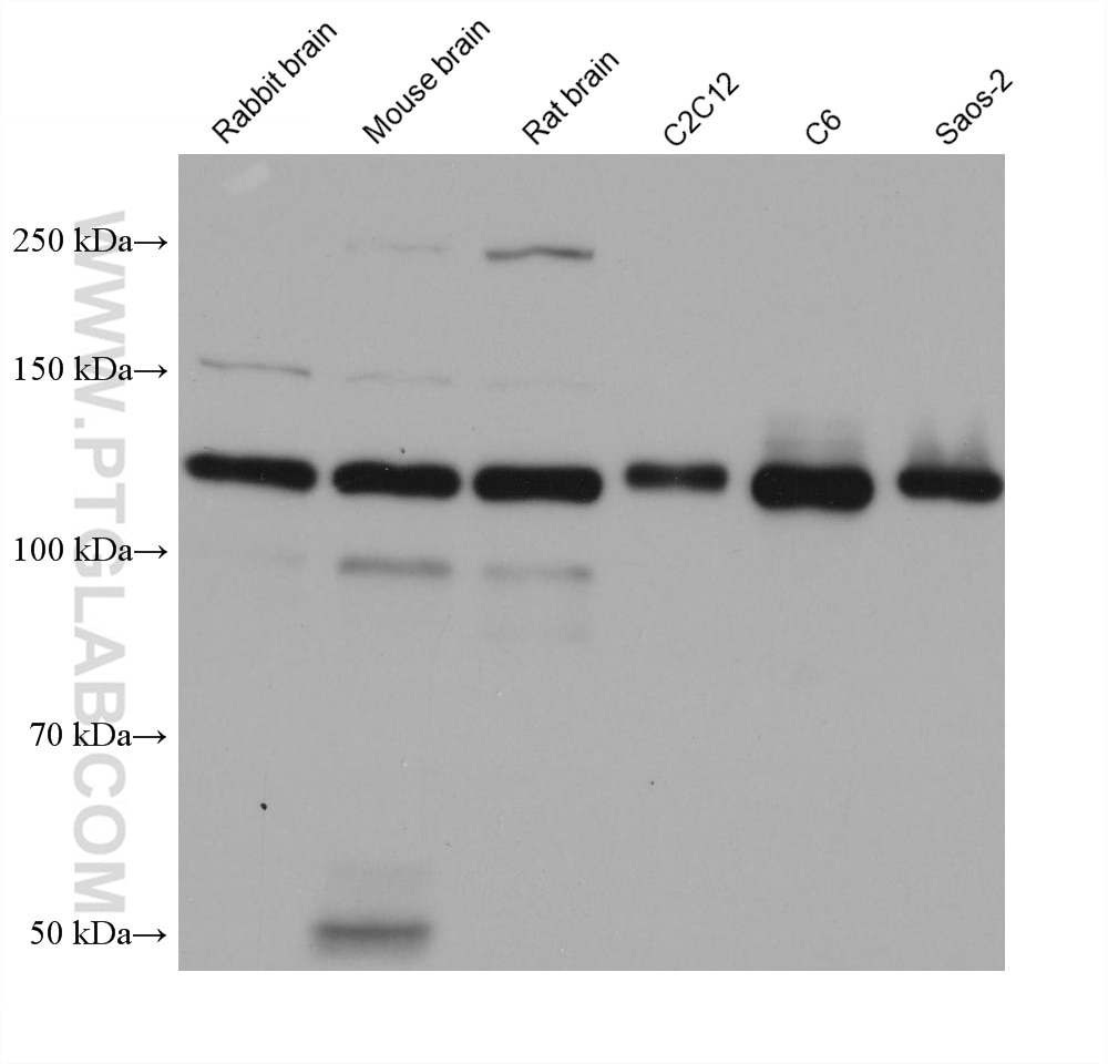 Western Blot (WB) analysis of various lysates using N-cadherin Monoclonal antibody (66219-1-Ig)