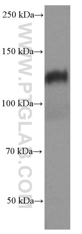 Western Blot (WB) analysis of rat brain tissue using N-cadherin Monoclonal antibody (66219-1-Ig)