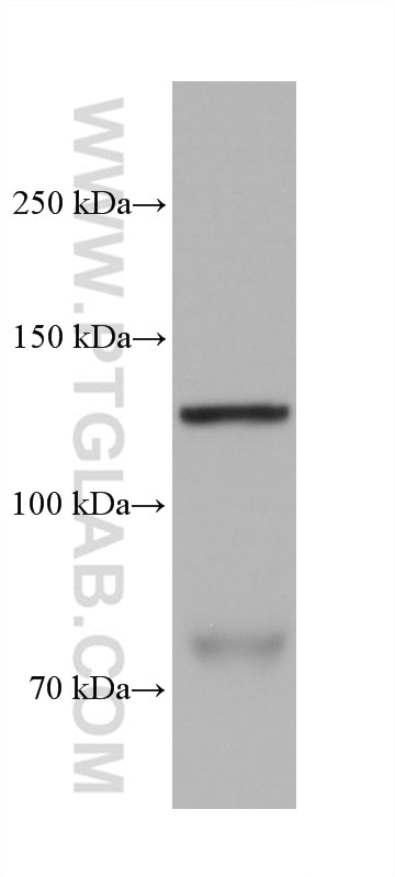 Western Blot (WB) analysis of hTERT-RPE1 cells using N-cadherin Monoclonal antibody (68532-1-Ig)