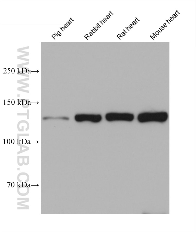 Western Blot (WB) analysis of various lysates using N-cadherin Monoclonal antibody (68532-1-Ig)