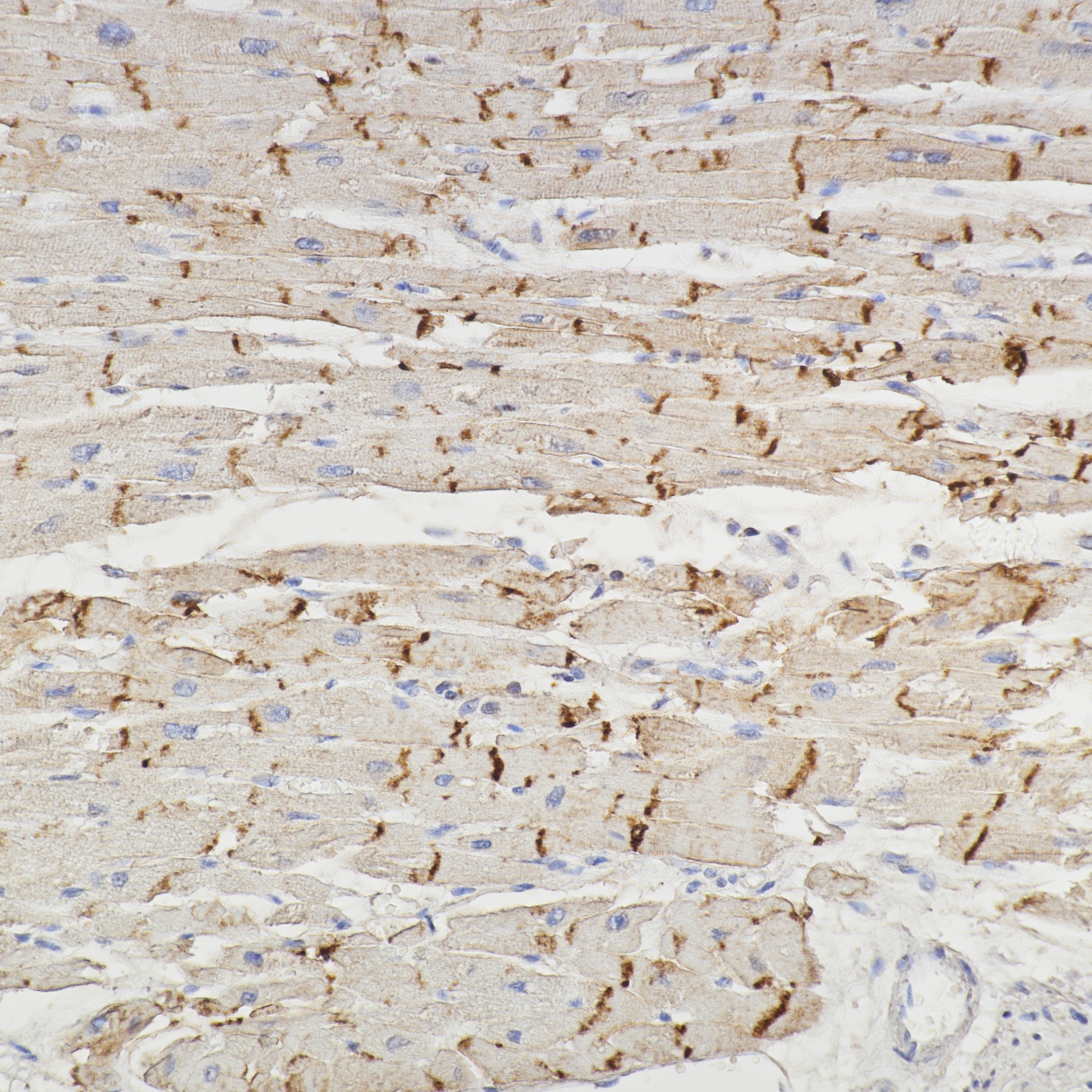 Immunohistochemistry (IHC) staining of human heart tissue using N-cadherin Recombinant monoclonal antibody (82968-1-RR)