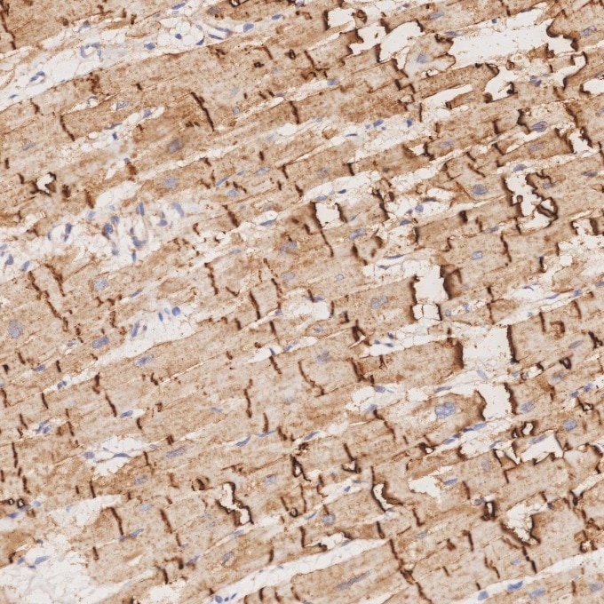 Immunohistochemistry (IHC) staining of human heart tissue using N-cadherin Recombinant monoclonal antibody (82968-1-RR)