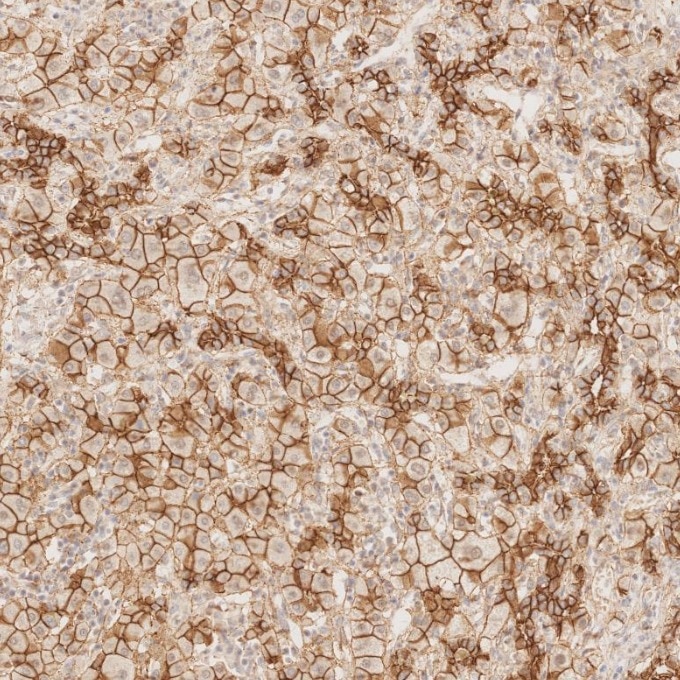 Immunohistochemistry (IHC) staining of human liver tissue using N-cadherin Recombinant monoclonal antibody (82968-1-RR)
