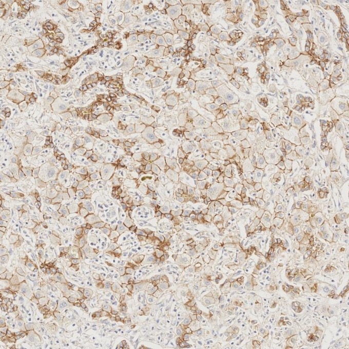 Immunohistochemistry (IHC) staining of human liver tissue using N-cadherin Recombinant monoclonal antibody (82968-1-RR)