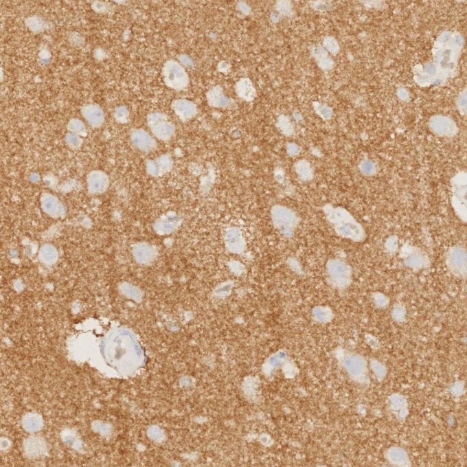 Immunohistochemistry (IHC) staining of human brain tissue using N-cadherin Recombinant monoclonal antibody (82968-1-RR)