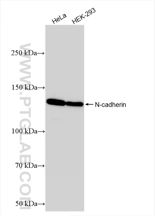 Western Blot (WB) analysis of various lysates using N-cadherin Recombinant antibody (82968-1-RR)