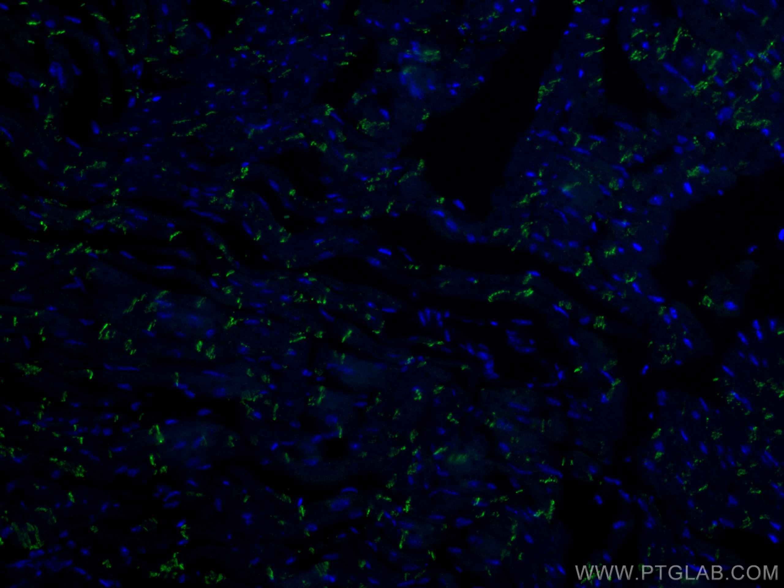 Immunofluorescence (IF) / fluorescent staining of mouse heart tissue using CoraLite® Plus 488-conjugated N-cadherin Polyclona (CL488-22018)