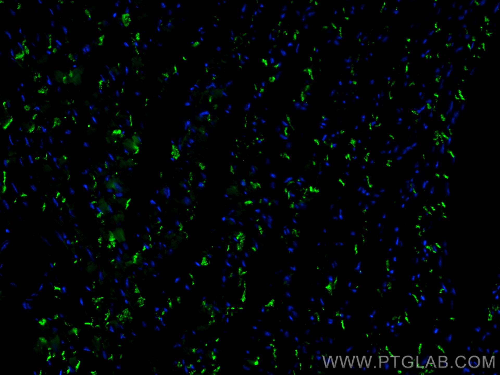 IF Staining of mouse heart using CL488-22018