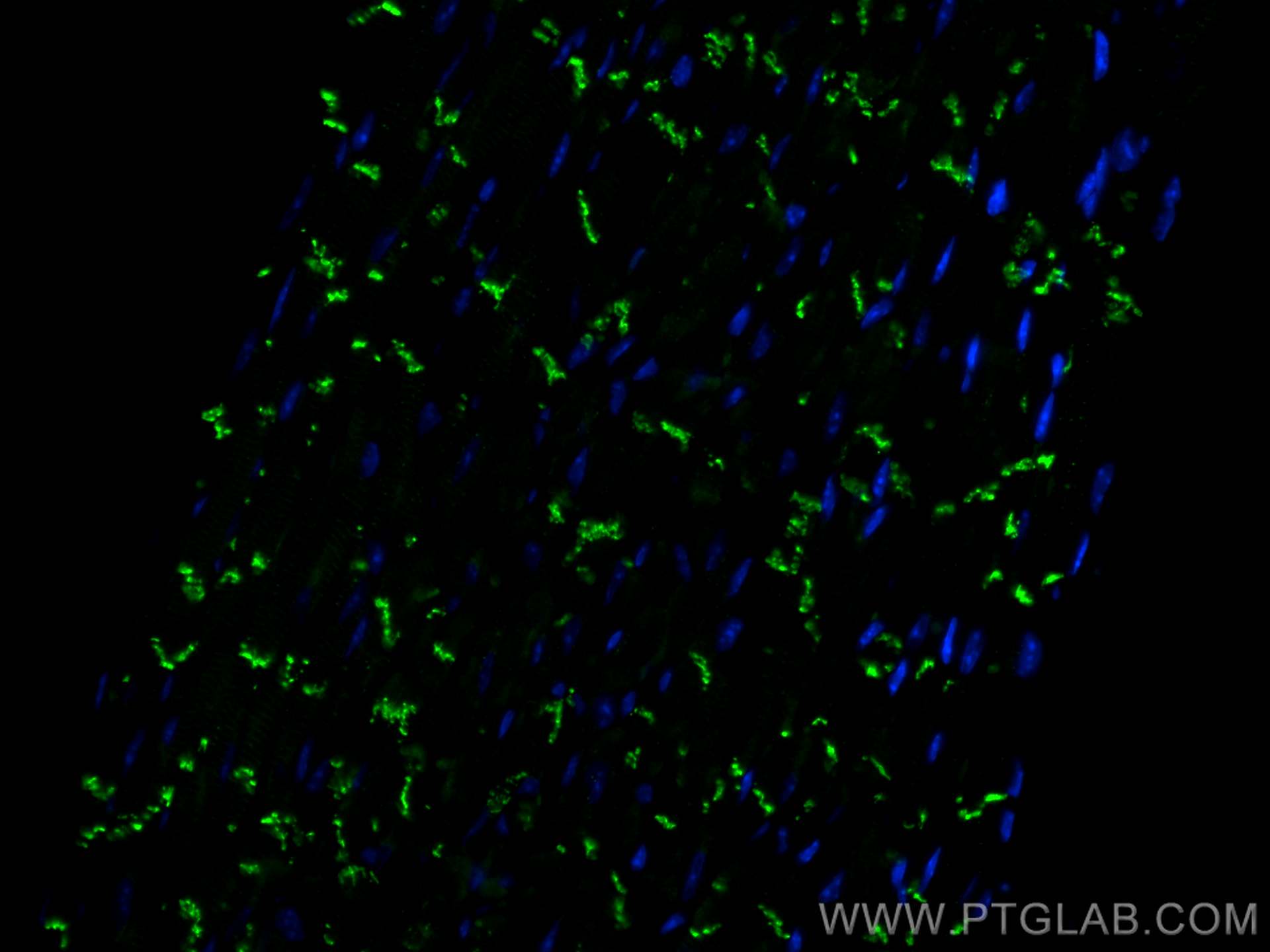 Immunofluorescence (IF) / fluorescent staining of mouse heart tissue using CoraLite® Plus 488-conjugated N-cadherin Polyclona (CL488-22018)