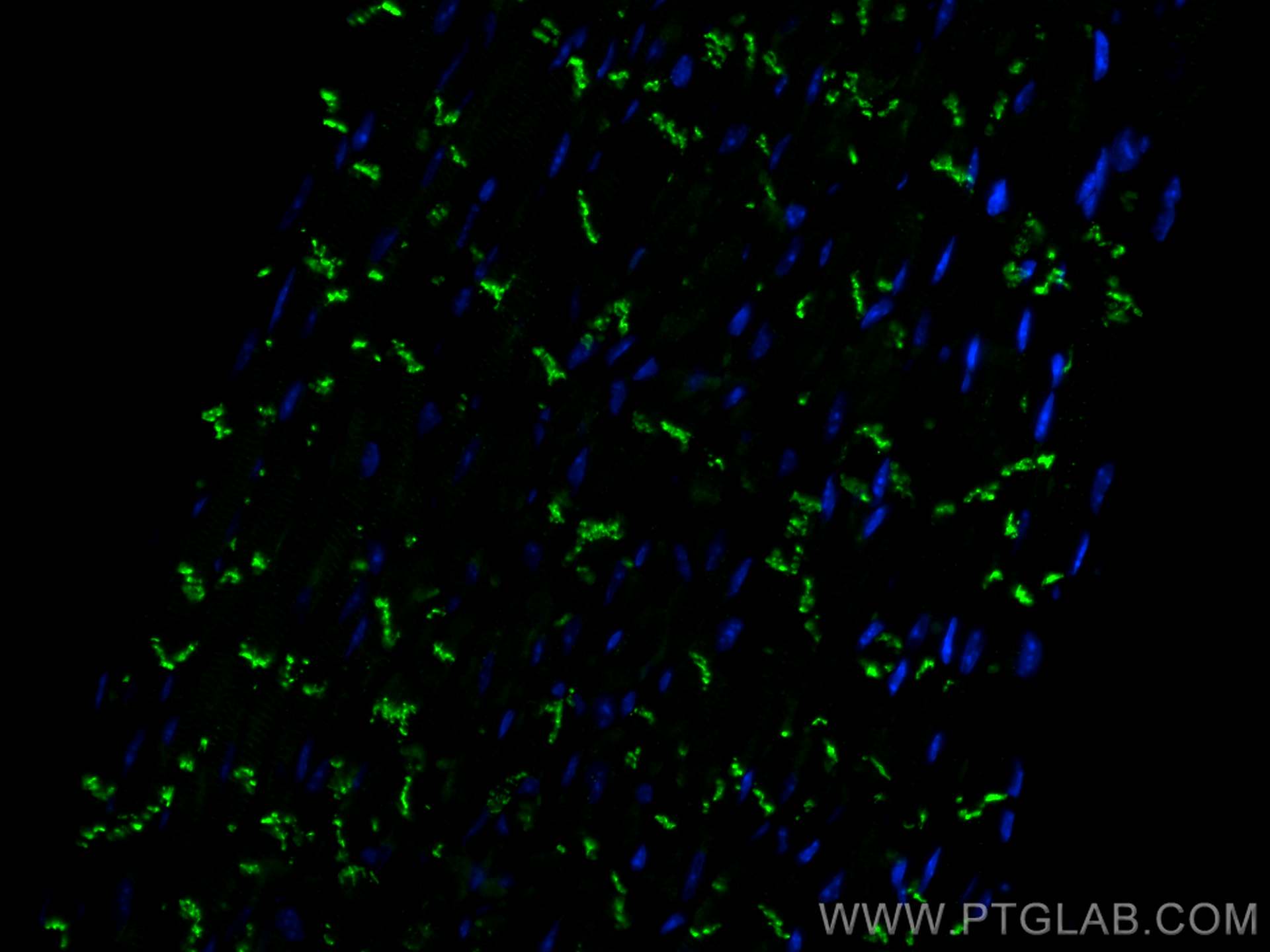 IF Staining of mouse heart using CL488-22018