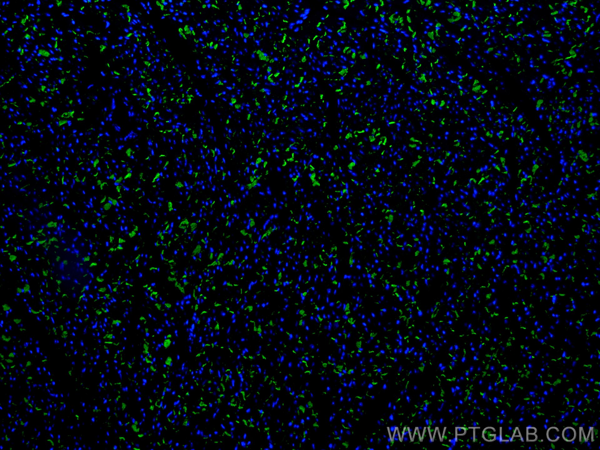 Immunofluorescence (IF) / fluorescent staining of mouse heart tissue using CoraLite® Plus 488-conjugated N-cadherin Monoclona (CL488-66219)