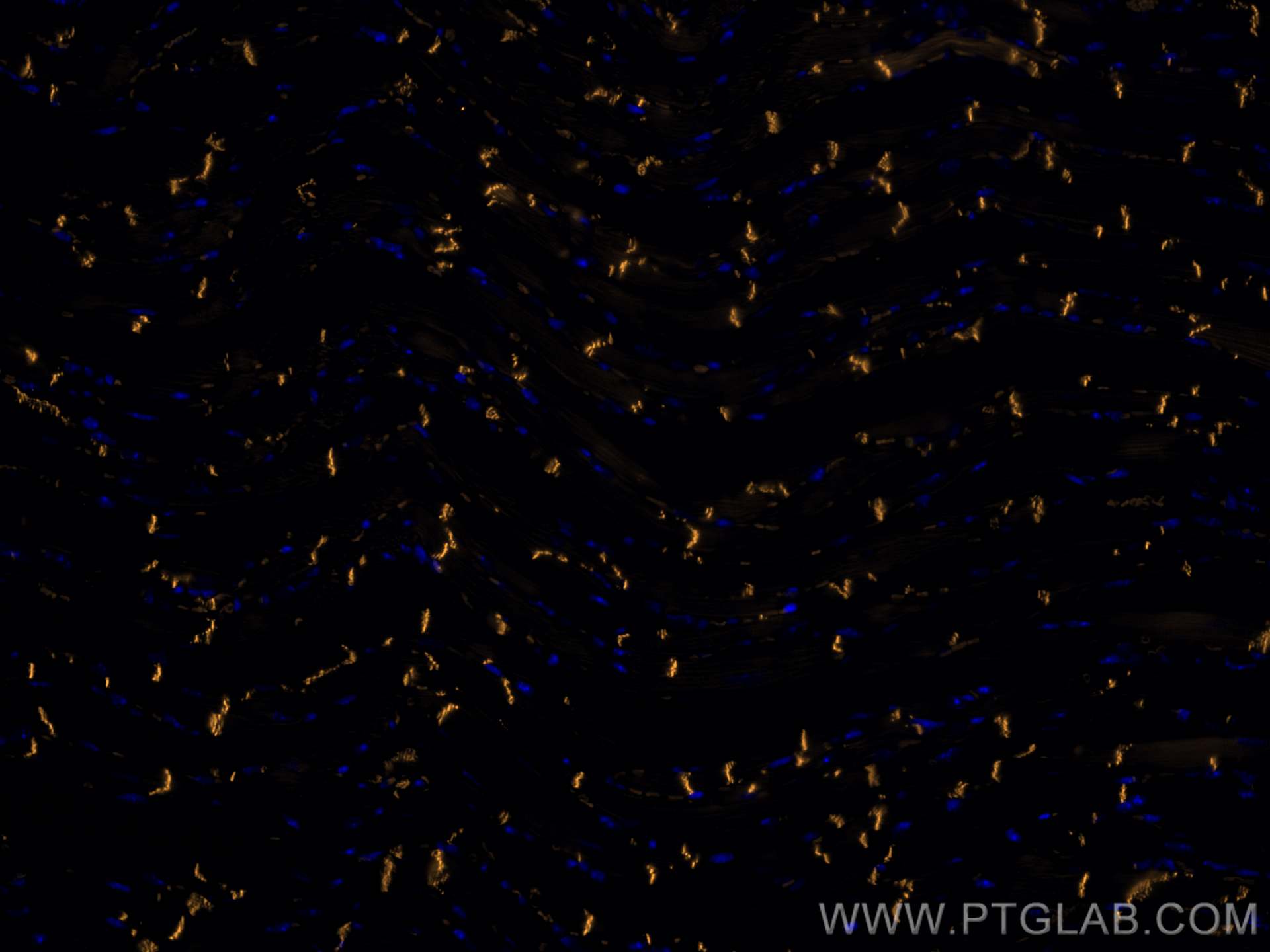 Immunofluorescence (IF) / fluorescent staining of mouse heart tissue using CoraLite® Plus 555-conjugated N-cadherin Monoclona (CL555-66219)