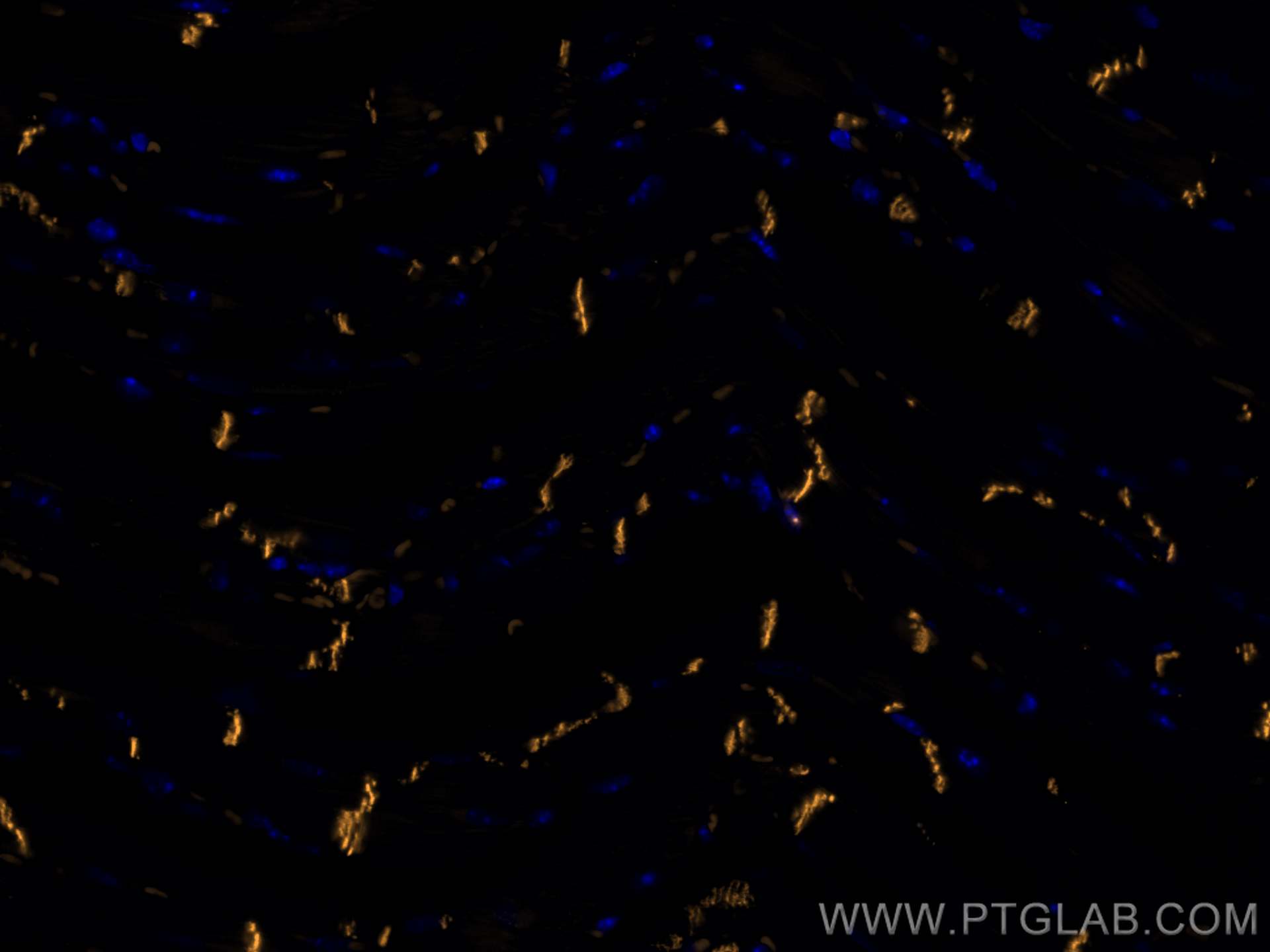 Immunofluorescence (IF) / fluorescent staining of mouse heart tissue using CoraLite® Plus 555-conjugated N-cadherin Monoclona (CL555-66219)