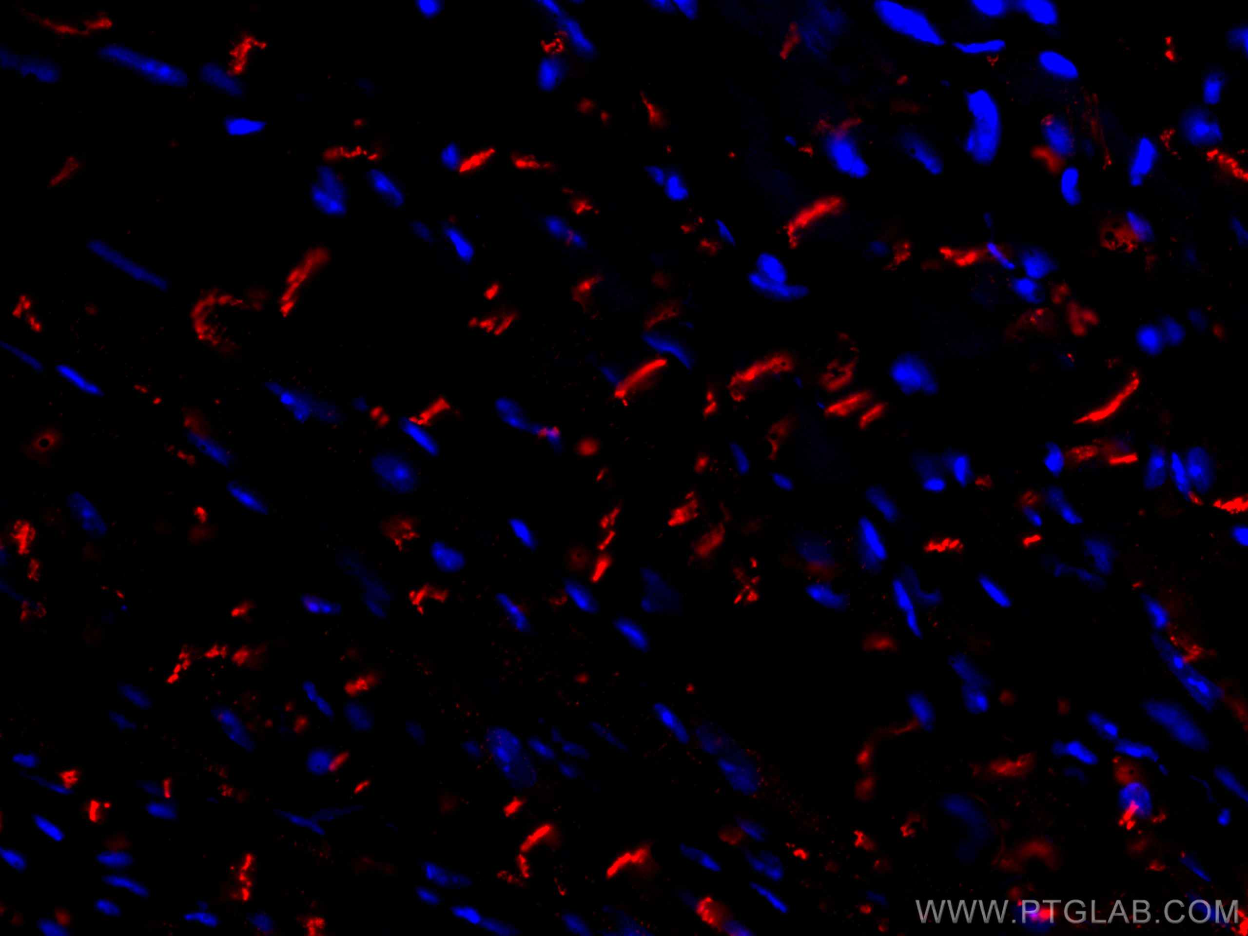 Immunofluorescence (IF) / fluorescent staining of mouse heart tissue using CoraLite®594-conjugated N-cadherin Polyclonal anti (CL594-22018)