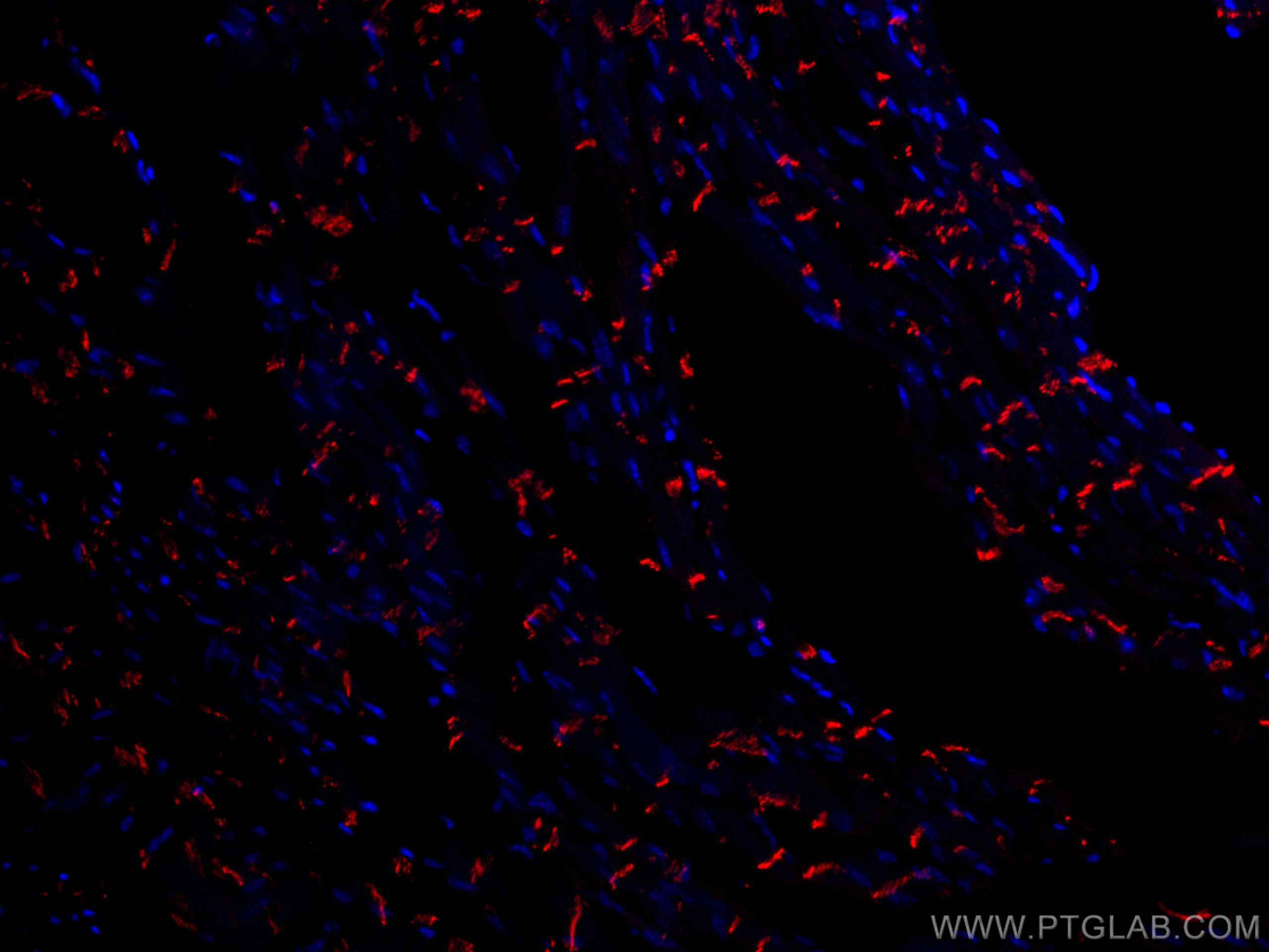 Immunofluorescence (IF) / fluorescent staining of mouse heart tissue using CoraLite®594-conjugated N-cadherin Polyclonal anti (CL594-22018)