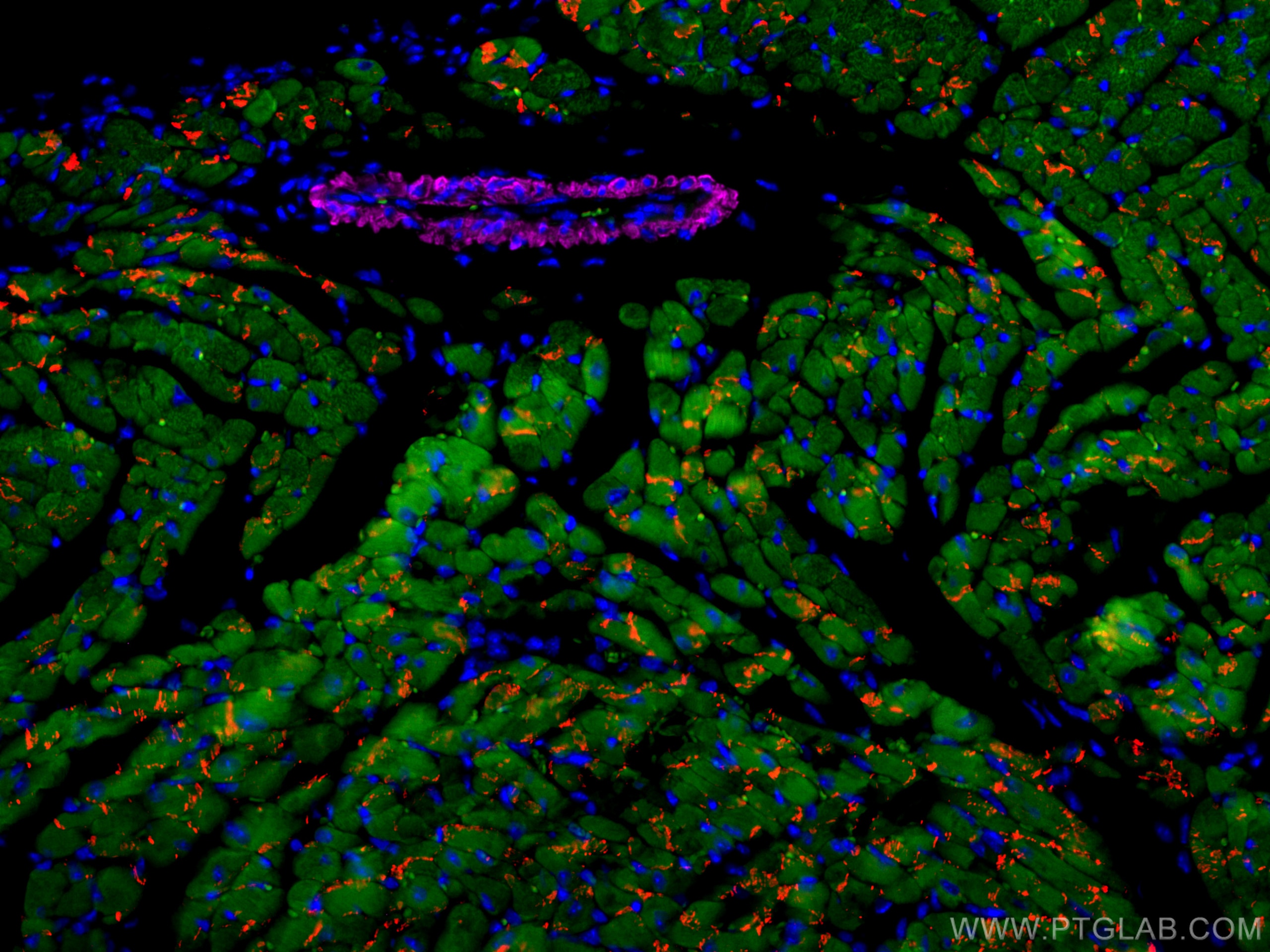 Immunofluorescence (IF) / fluorescent staining of mouse heart tissue using CoraLite®594-conjugated N-cadherin Polyclonal anti (CL594-22018)