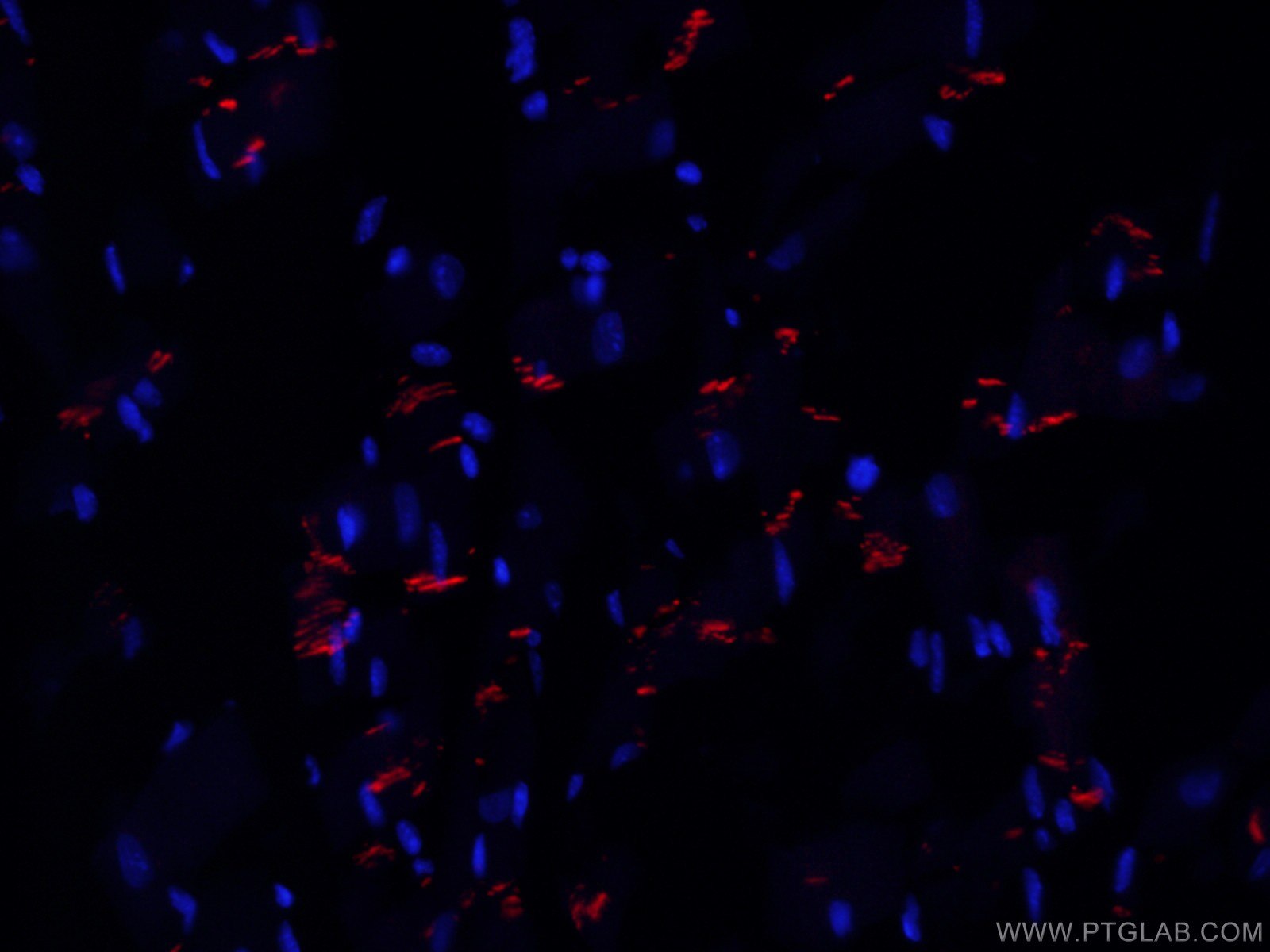 IF Staining of mouse heart using CL594-66219