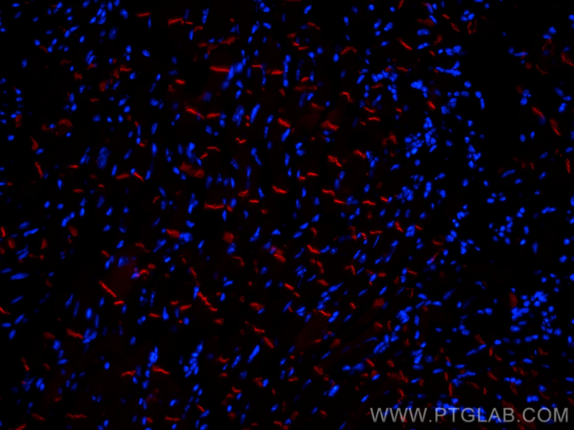 Immunofluorescence (IF) / fluorescent staining of mouse heart tissue using CoraLite®594-conjugated N-cadherin Monoclonal anti (CL594-66219)