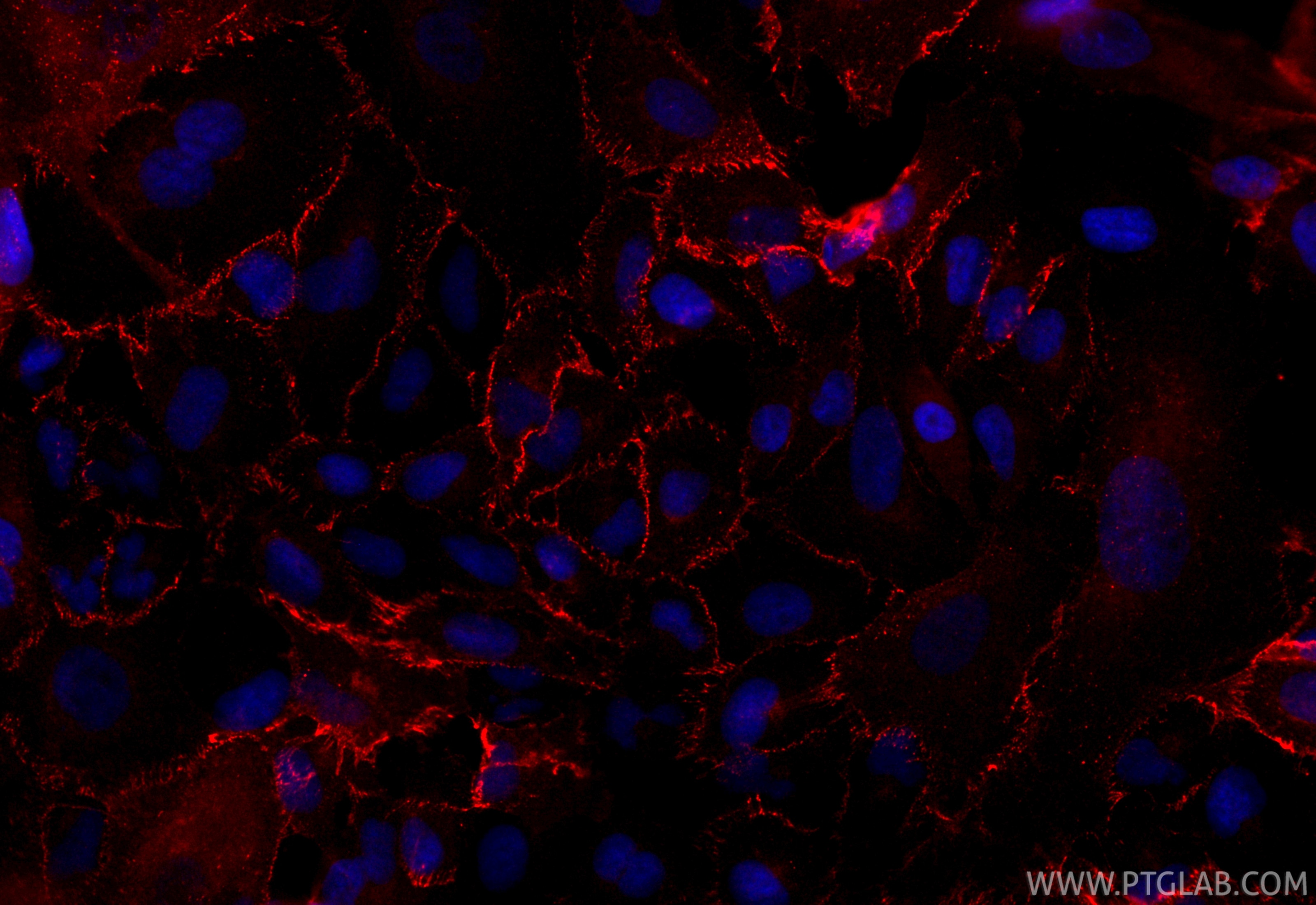 Immunofluorescence (IF) / fluorescent staining of A549 cells using CoraLite®594-conjugated N-cadherin Recombinant ant (CL594-82968)