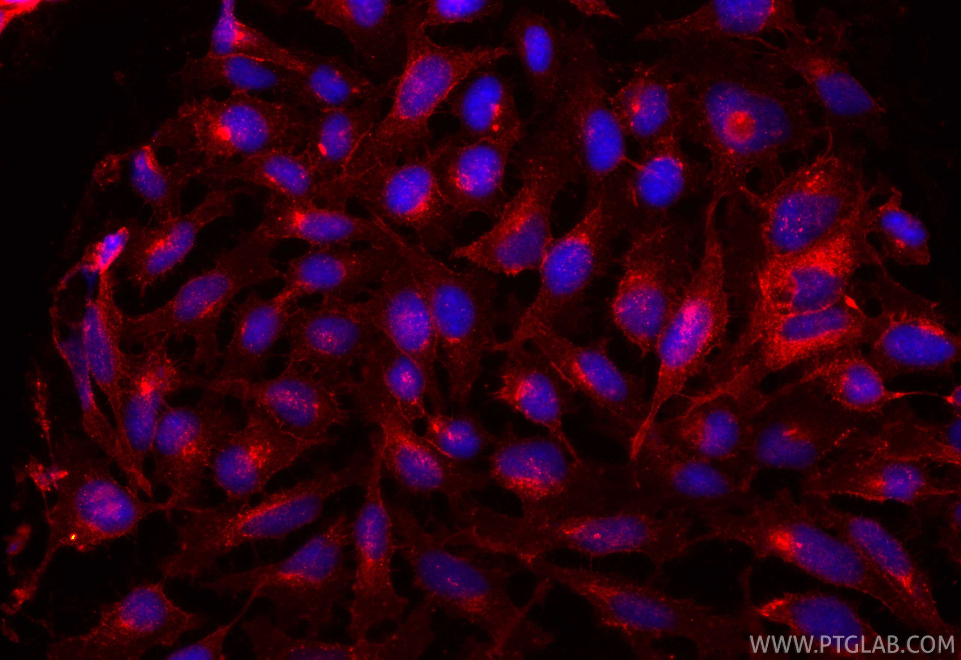 Immunofluorescence (IF) / fluorescent staining of HeLa cells using CoraLite®594-conjugated N-cadherin Recombinant ant (CL594-82968)
