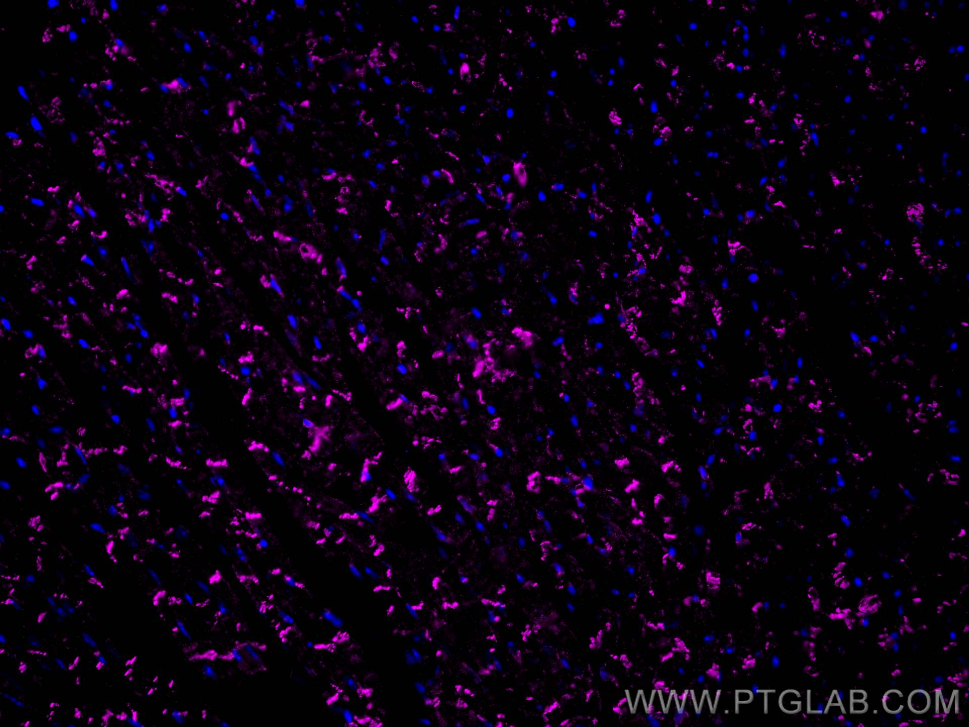 Immunofluorescence (IF) / fluorescent staining of mouse heart tissue using CoraLite® Plus 647-conjugated N-cadherin Monoclona (CL647-66219)