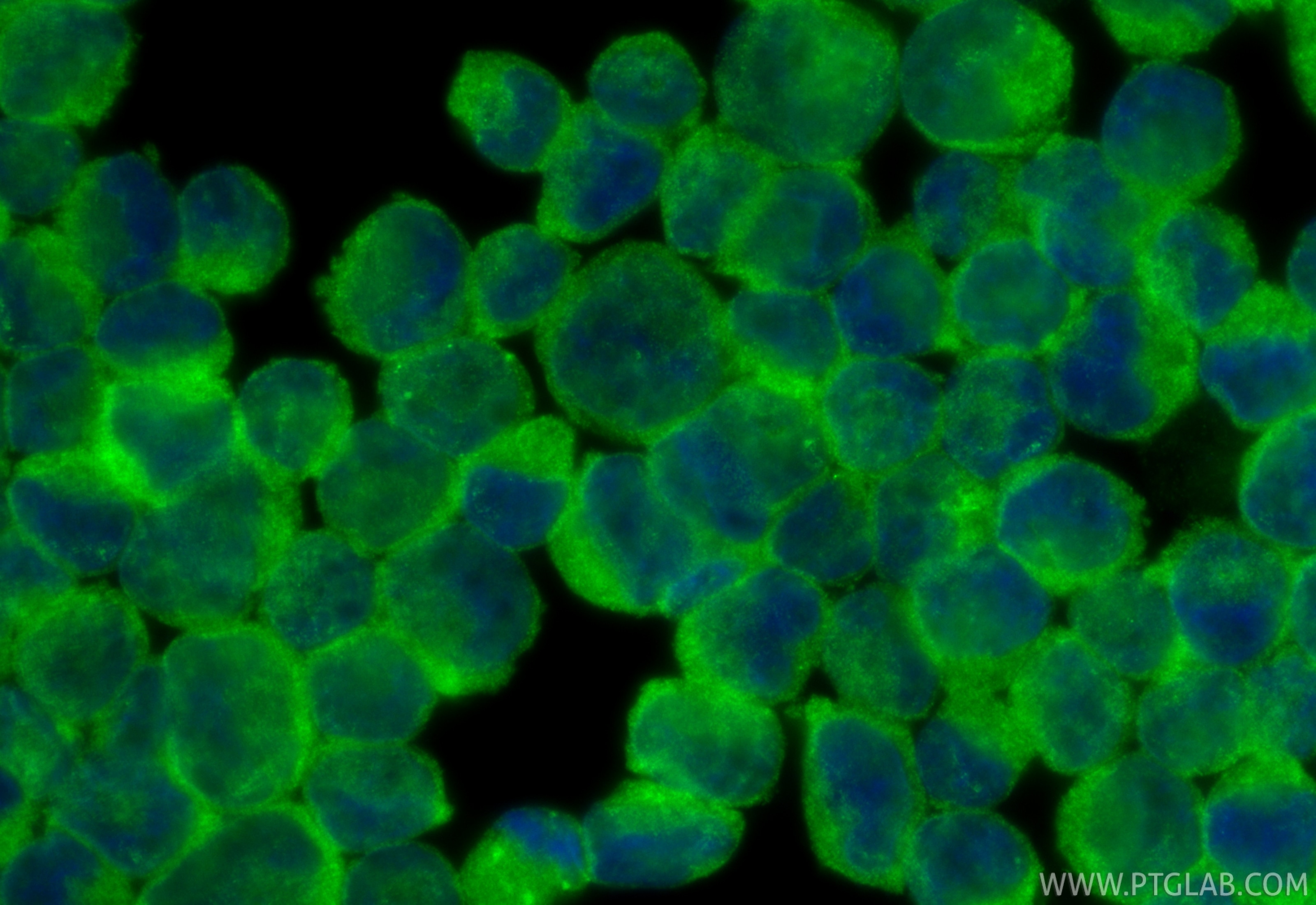 IF Staining of K-562 using 23892-1-AP Immunofluorescence (IF) / fluorescent staining of K-562 cells using N4BP2 Polyclonal antibody (23892-1-AP)