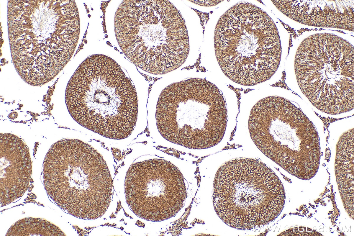 Immunohistochemistry (IHC) staining of rat testis tissue using N4BP2 Polyclonal antibody (23892-1-AP)