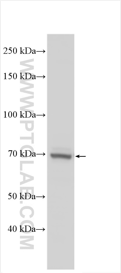 Western Blot (WB) analysis of various lysates using N4BP2L2 Polyclonal antibody (17159-1-AP)