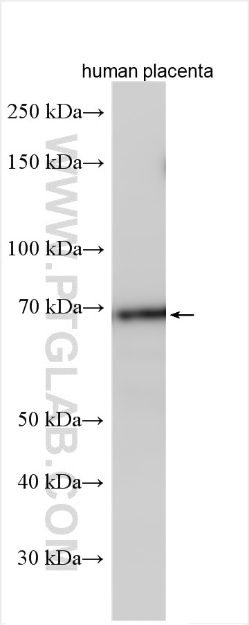 Western Blot (WB) analysis of various lysates using N4BP2L2 Polyclonal antibody (17159-1-AP)