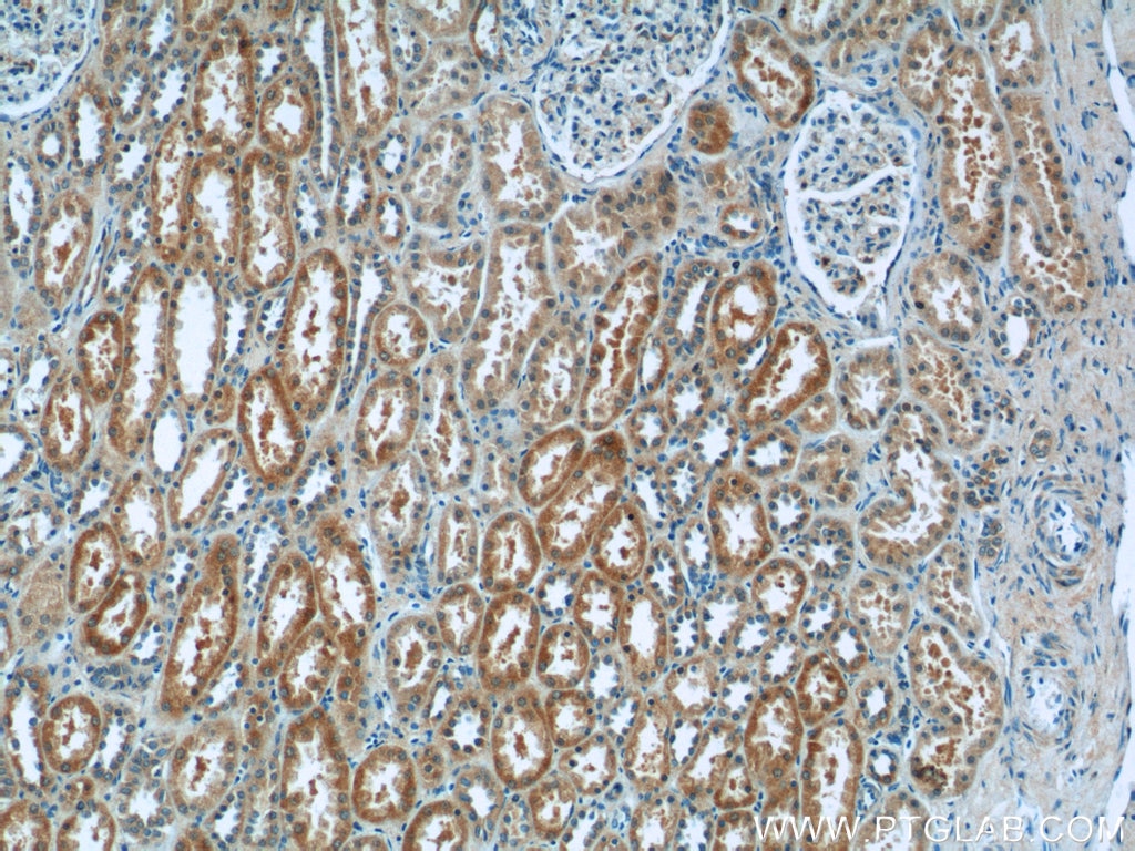 Immunohistochemistry (IHC) staining of human kidney tissue using N4BP3 Polyclonal antibody (16733-1-AP)