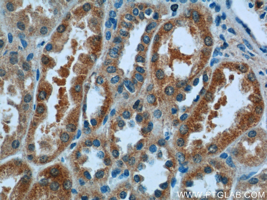 Immunohistochemistry (IHC) staining of human kidney tissue using N4BP3 Polyclonal antibody (16733-1-AP)