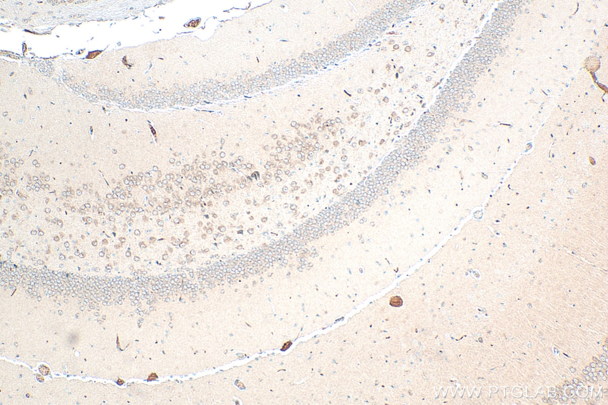 Immunohistochemistry (IHC) staining of mouse brain tissue using N4BP3 Polyclonal antibody (16733-1-AP)