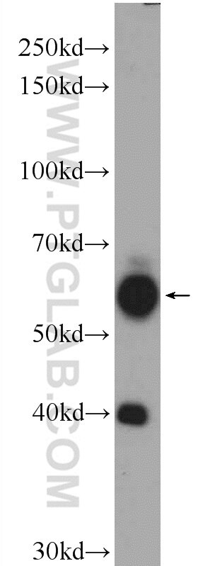 Western Blot (WB) analysis of mouse brain tissue using N4BP3 Polyclonal antibody (16733-1-AP)