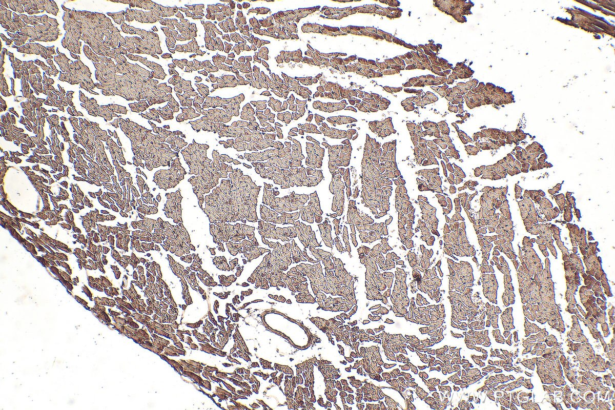 Immunohistochemistry (IHC) staining of mouse heart tissue using N6AMT1 Polyclonal antibody (16211-1-AP)