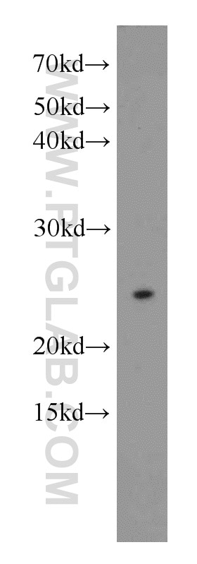 Western Blot (WB) analysis of HEK-293 cells using N6AMT1 Polyclonal antibody (16211-1-AP)