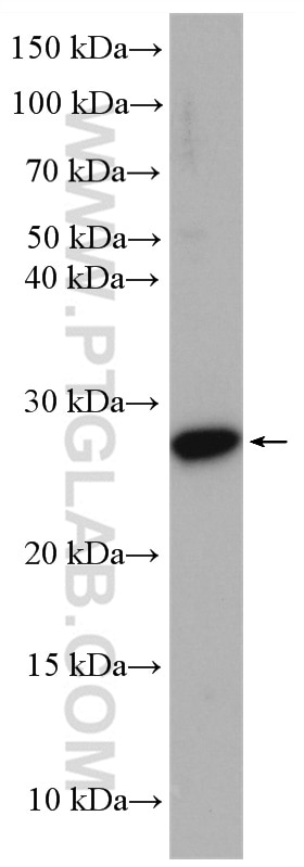 Western Blot (WB) analysis of HEK-293 cells using N6AMT2 Polyclonal antibody (16954-1-AP)