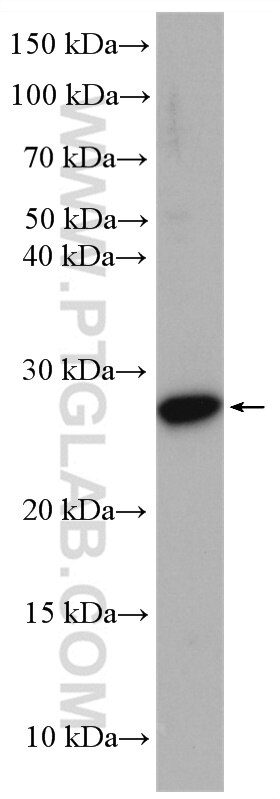 WB analysis of HEK-293 using 16954-1-AP