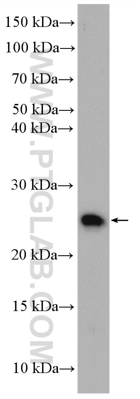 Western Blot (WB) analysis of Jurkat cells using N6AMT2 Polyclonal antibody (16954-1-AP)