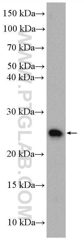 Western Blot (WB) analysis of Jurkat cells using N6AMT2 Polyclonal antibody (16954-1-AP)