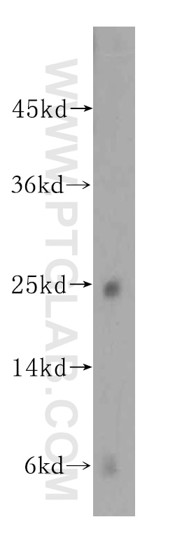 WB analysis of K-562 using 16954-1-AP