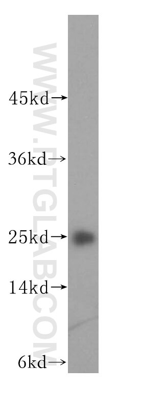 Western Blot (WB) analysis of mouse ovary tissue using N6AMT2 Polyclonal antibody (16954-1-AP)