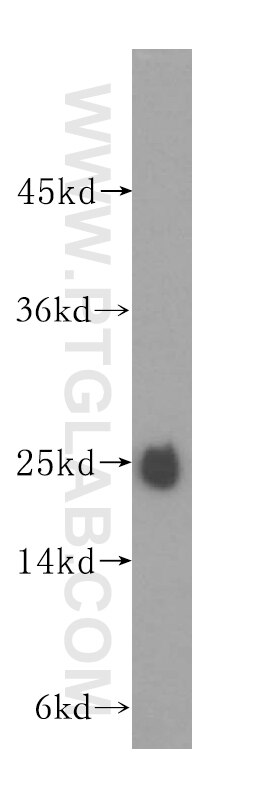 Western Blot (WB) analysis of mouse testis tissue using N6AMT2 Polyclonal antibody (16954-1-AP)